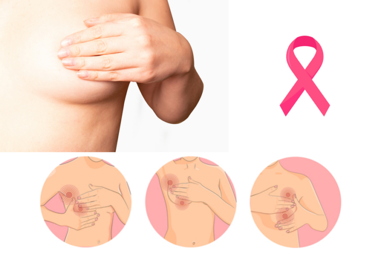 Cáncer de mama: no es una sola enfermedad, son cuatro afecciones diferentes