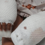 Imputada de Maltrato Infantil Recibe Prisión Preventiva Tras Causar Quemaduras a Su Hijo de Cuatro Años