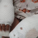 Aplazan nuevamente audiencia de medida de coerción contra madre acusada de quemar manos de su hijo