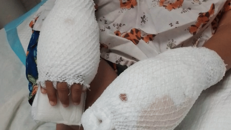 Aplazan nuevamente audiencia de medida de coerción contra madre acusada de quemar manos de su hijo Aplazan nuevamente audiencia de medida de coerción contra madre acusada de quemar manos de su hijo