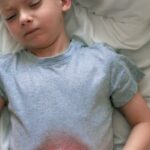 Orientan método para la gastroenteritis en niños